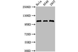 Western Blot Positive WB detected in: Hela whole cell lysate, A549 whole cell lysate, 293T whole cell lysate All lanes:ECT2 antibody at 2. (ECT2 抗体  (AA 283-453))
