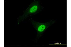 Immunofluorescence of monoclonal antibody to CAPN3 on HeLa cell. (Calpain 3 抗体  (AA 210-309))