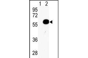 Western blot analysis of AKT2 (arrow) using rabbit polyclonal AKT2 Antibody (Center) (ABIN391023 and ABIN2841193). (AKT2 抗体  (AA 93-123))