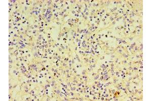 Immunohistochemistry of paraffin-embedded human spleen tissue using ABIN7174112 at dilution of 1:100 (PTPN5 抗体  (AA 300-555))