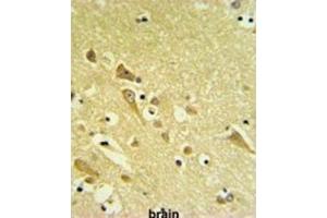 Immunohistochemistry (IHC) image for anti-Proteasomal ATPase-Associated Factor 1 (PAAF1) antibody (ABIN3002221) (PAAF1 抗体)