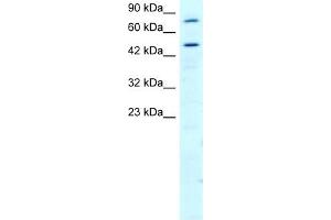 RGS9 antibody used at 2 ug/ml to detect target protein. (RGS 抗体  (N-Term))