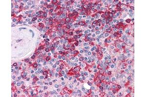 anti-Membrane Protein, Palmitoylated 5 (MAGUK P55 Subfamily Member 5) (MPP5) (AA 124-187) antibody