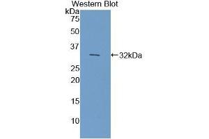 Detection of Recombinant CYP7A1, Mouse using Polyclonal Antibody to Cytochrome P450 7A1 (CYP7A1) (CYP7A1 抗体  (AA 227-467))