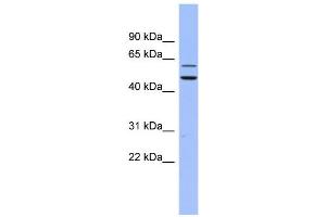 WB Suggested Anti-DKC1 Antibody Titration:  0. (DKC1 抗体  (N-Term))
