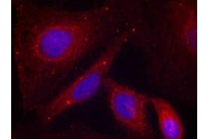 Immunofluorescence staining of methanol-fixed Hela cells using PAK1(Phospho-Thr212) Antibody. (PAK1 抗体  (pThr212))