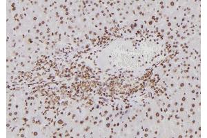 ABIN6276797 at 1/100 staining Mouse liver tissue by IHC-P. (BTRC 抗体  (N-Term))