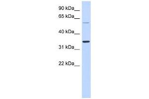 SASP antibody used at 1 ug/ml to detect target protein. (ASPRV1 抗体  (Middle Region))
