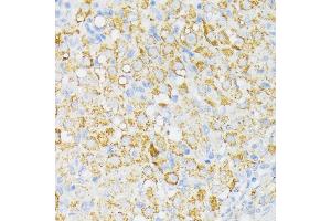 Immunohistochemistry of paraffin-embedded rat ovary using USP33 antibody (ABIN7271157) at dilution of 1:100 (40x lens).
