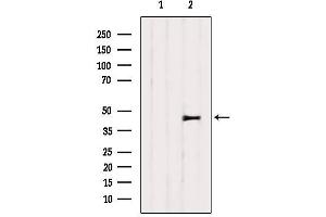 Western blot analysis of extracts from 3T3, using SERPINH1 Antibody. (SERPINH1 抗体  (Internal Region))