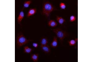 IF analysis of MEK5/MAP2K5 using anti-MEK5/MAP2K5 antibody (ABIN7601657). (MAP2K5 抗体  (AA 401-445))