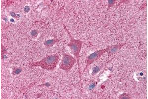 Human Brain, Cortex: Formalin-Fixed, Paraffin-Embedded (FFPE) (NUMB 抗体  (AA 1-214))