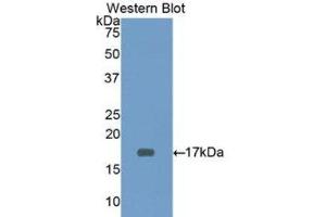 Western Blotting (WB) image for anti-CD3d Molecule, delta (CD3-TCR Complex) (CD3D) (AA 18-113) antibody (ABIN1175133) (CD3D 抗体  (AA 18-113))