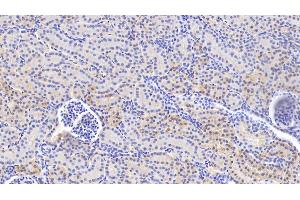 Detection of VCL in Human Kidney Tissue using Anti-Vinculin (VCL) Polyclonal Antibody (Vinculin 抗体  (AA 1020-1134))