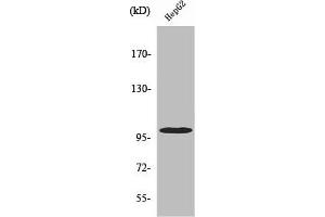 Western Blot analysis of HeLa cells using Vav2 Polyclonal Antibody (VAV2 抗体)