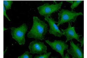ICC/IF analysis of GST in HeLa cells line, stained with DAPI (Blue) for nucleus staining and monoclonal anti-human GST antibody (1:100) with goat anti-mouse IgG-Alexa fluor 488 conjugate (Green). (GST 抗体)