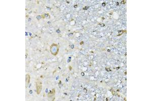 Immunohistochemistry of paraffin-embedded mouse spinal cord using DARS antibody (ABIN5973949) at dilution of 1/100 (40x lens). (DARS 抗体)