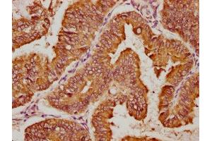 anti-DnaJ (Hsp40) Homolog, Subfamily C, Member 1 (DNAJC1) (AA 521-793) antibody