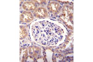 SLCO4C1 Antibody immunohistochemistry analysis in formalin fixed and paraffin embedded human kidney tissue followed by peroxidase conjugation of the secondary antibody and DAB staining. (SLCO4C1 抗体  (C-Term))