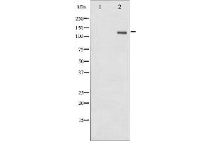 Western blot analysis of FAK phosphorylation expression in HepG2 whole cell lysates,The lane on the left is treated with the antigen-specific peptide. (FAK 抗体  (pTyr861))
