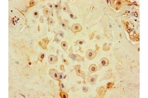 Immunohistochemistry of paraffin-embedded human placenta tissue using ABIN7147190 at dilution of 1:100