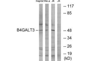 Western Blotting (WB) image for anti-UDP-Gal:betaGlcNAc beta 1,4- Galactosyltransferase, Polypeptide 3 (B4GALT3) (Internal Region) antibody (ABIN5977439) (B4GALT3 抗体  (Internal Region))