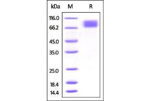 SDS-PAGE (SDS) image for Colony Stimulating Factor 1 Receptor (CSF1R) (AA 20-511) (Active) protein (His tag) (ABIN4949179)