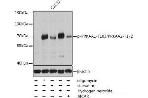 Western blot analysis of extracts of C2C12 cells using Phospho-PRKAA1(T183)/PRKAA2(T172) Polyclonal Antibody at dilution of 1:2000. (PRKAA1 抗体  (pThr172, pThr183))