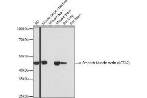Western blot analysis of extracts of various cell lines, using α-Smooth Muscle Actin  antibody (ABIN7265392) at 1:1000 dilution. (Smooth Muscle Actin 抗体)