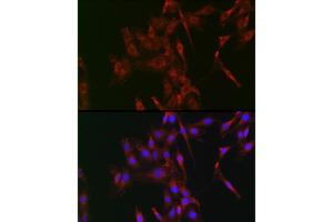 Immunofluorescence analysis of C6 cells using LOX Rabbit pAb (ABIN6133805, ABIN6143288, ABIN6143289 and ABIN6223629) at dilution of 1:100 (40x lens). (LOX 抗体)