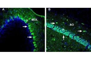 Expression of DPP10 in mouse cerebellum and hippocampus - Immunohistochemical staining of perfusion-fixed frozen mouse brain sections with Anti-DPP10 (extracellular) Antibody (ABIN7043099, ABIN7045044 and ABIN7045045), (1:1000), followed by goat anti-rabbit-AlexaFluor-488. (DPP10 抗体  (C-Term, Extracellular))
