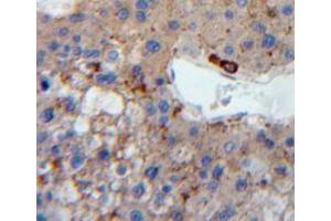 Used in DAB staining on fromalin fixed paraffin-embedded liver tissue (LDLR 抗体  (AA 263-509))