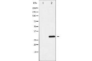 Western blot analysis of Cyclin D3 expression in Forskolin treated COS7 whole cell lysates,The lane on the left is treated with the antigen-specific peptide. (Cyclin D3 抗体)