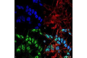 Immunocytochemistry/Immunofluorescence analysis using Rabbit Anti-Beclin 1 Polyclonal Antibody . (Beclin 1 抗体  (FITC))
