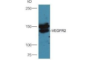 Mouse lung lysates probed with Anti-VEGFR2 Polyclonal Antibody  at 1:5000 90min in 37˚C. (VEGFR2/CD309 抗体  (AA 101-200))