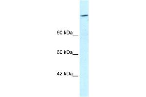 WB Suggested Anti-ARID4A Antibody Titration:  1. (ARID4A 抗体  (C-Term))