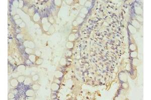 Immunohistochemistry of paraffin-embedded human small intestine tissue using ABIN7164683 at dilution of 1:100