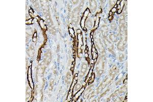 Immunohistochemistry of paraffin-embedded mouse kidney using  Rabbit pAb (ABIN3016811, ABIN3016812, ABIN3016813, ABIN1678723 and ABIN6219847) at dilution of 1:50 (40x lens). (AQP3 抗体  (AA 178-292))