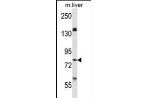 KI Antibody  (ABIN652432 and ABIN2842239) western blot analysis in mouse liver tissue lysates (35 μg/lane). (BRSK1 抗体  (C-Term))