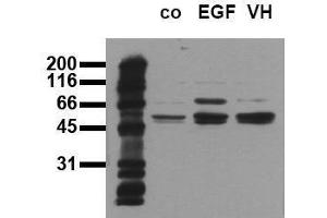 Western Blotting (WB) image for anti-SHC (Src Homology 2 Domain Containing) Transforming Protein 1 (SHC1) (pTyr317) antibody (ABIN126889) (SHC1 抗体  (pTyr317))