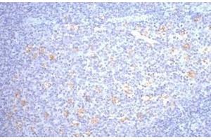 Immunohistochemistry of paraffin-embedded Human tonsil tissue using CD68 Monoclonal Antibody at dilution of 1:200. (CD68 抗体)