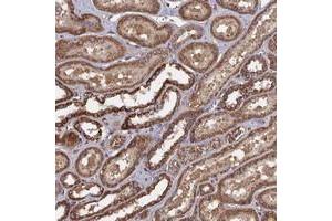Immunohistochemical staining of human kidney with SPANXN4 polyclonal antibody  shows strong cytoplasmic positivity in cells of tubules at 1:10-1:20 dilution. (SPANXN4 抗体)
