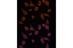 Immunofluorescence analysis of L929 cells using TMED2 antibody (ABIN7270943) at dilution of 1:100. (TMED2 抗体  (AA 60-170))