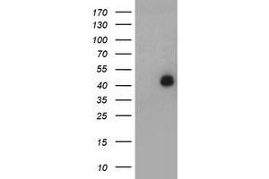Image no. 1 for anti-LIM Homeobox 1 (LHX1) (AA 100-362) antibody (ABIN1490807) (LHX1 抗体  (AA 100-362))