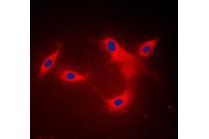 Immunofluorescent analysis of LYPLA1 staining in MDAMB453 cells. (LYPLA1 抗体  (Center))