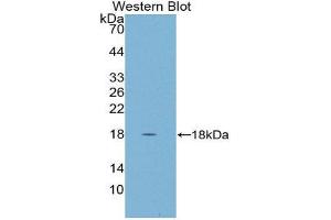Western Blotting (WB) image for anti-Cystatin D (CST5) (AA 21-142) antibody (ABIN1867419) (CST5 抗体  (AA 21-142))