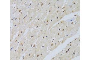 Immunohistochemistry of paraffin-embedded Rat heart using SNRPA Polyclonal Antibody at dilution of 1:100 (40x lens). (SNRPA1 抗体)