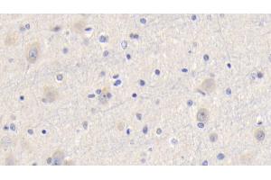 Detection of CYPA in Human Cerebrum Tissue using Polyclonal Antibody to Cyclophilin A (CYPA) (PPIA 抗体  (AA 2-165))