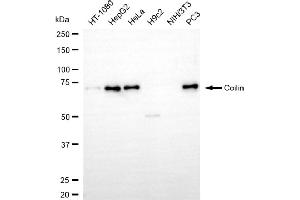 Western blotting analysis using coilin antibody (ABIN7798119). (Recombinant Coilin 抗体)