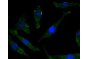 Immunofluorescence (Cultured Cells) (IF (cc)) image for anti-Neurotrophic Tyrosine Kinase, Receptor, Type 2 (NTRK2) (pTyr817) antibody (ABIN5557345)